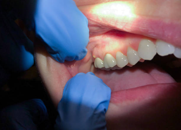 Best Walk-In Dentist Near Me  in Marienville, PA
