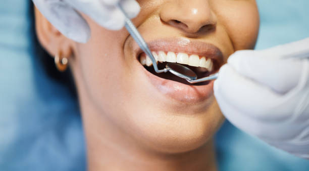 Best Broken Tooth Emergency  in Marienville, PA