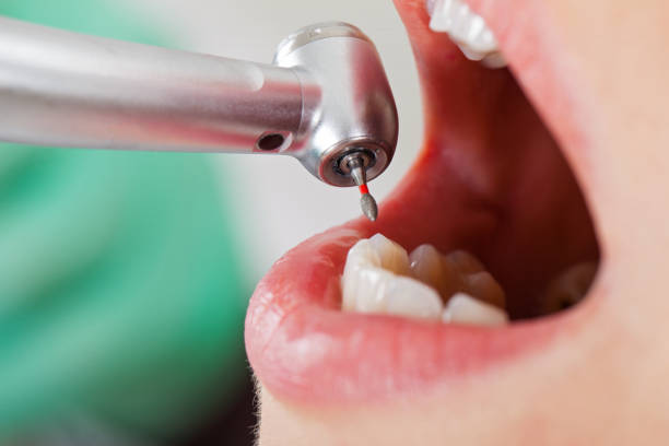 Best Tooth Pain Emergency Relief  in Marienville, PA